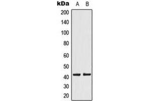 Western blot analysis of KCNK15 expression in JEG3 (A), HeLa (B) whole cell lysates.