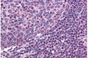 Colon, lymphoid follicle (MALT1 Antikörper  (AA 43-57))