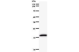 Western Blotting (WB) image for anti-Endonuclease 8-like 2 (NEIL2) antibody (ABIN933141) (NEIL2 Antikörper)