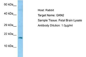 Western Blotting (WB) image for anti-Gastrokine 2 (GKN2) (N-Term) antibody (ABIN2790149) (Gastrokine 2 Antikörper  (N-Term))