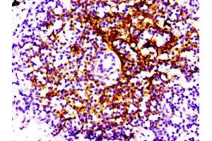 Immunohistochemistry (IHC) image for anti-Complement Component (3d/Epstein Barr Virus) Receptor 2 (CR2) antibody (ABIN7127277)