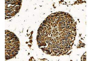 ABIN7095560 and ABIN7099617 at 1/100 staining mouse testis tissue by IHC-P. (ARPIN Antikörper)