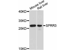 Western blot analysis of extracts of various cell lines, using SPRR3 antibody. (SPRR3 Antikörper)