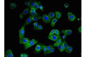 Immunofluorescent analysis of HepG2 cells using ABIN7147875 at dilution of 1:100 and Alexa Fluor 488-congugated AffiniPure Goat Anti-Rabbit IgG(H+L) (Claudin 1 Antikörper  (AA 185-224))