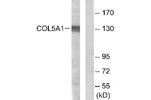 Immunohistochemistry analysis of paraffin-embedded human heart tissue using Collagen V α1 antibody. (COL5A1 Antikörper)