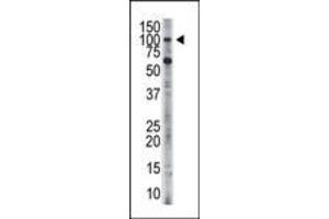 HK3 Antikörper  (C-Term)