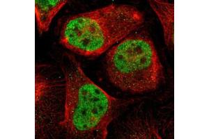 Immunofluorescent staining of U-2 OS with MEF2D polyclonal antibody  (Green) shows positivity in nucleus but excluded from the nucleoli.