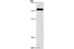 Western blot analysis of Hela cell, using ALOX15 Polyclonal Antibody at dilution of 1:1300