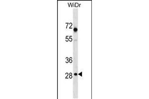 Western blot analysis in WiDr cell line lysates (35ug/lane). (SNX11 Antikörper  (AA 75-104))