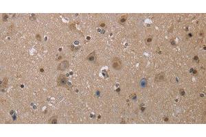 Immunohistochemistry of paraffin-embedded Human brain tissue using MGLL Polyclonal Antibody at dilution 1:40