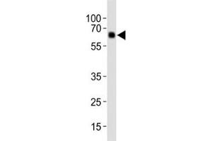 Western blot analysis of lysate from human placenta tissue, using Park6/ PINK1 antibody diluted at 1:1000. (PINK1 Antikörper  (AA 118-147))