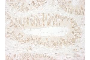 anti-SSB1 (AA 161-211) antibody
