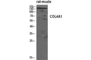 Western Blot (WB) analysis of specific cells using COL4A1 Polyclonal Antibody. (COL4A1 Antikörper  (N-Term))