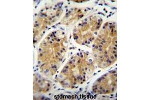 MGC24975 Antibody (C-term) immunohistochemistry analysis in formalin fixed and paraffin embedded human stomach tissue followed by peroxidase conjugation of the secondary antibody and DAB staining. (PRR22 Antikörper  (C-Term))