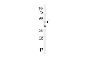 CRFR2D Antibody (ABIN655259 and ABIN2837856) western blot analysis in Hela cell line lysates (35 μg/lane). (CRFR2D Antikörper)