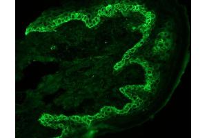 Immunohistochemistry on frozen section of swine skin showing basal cell staining (KRT14 Antikörper)