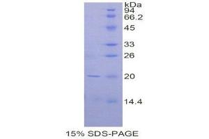 SDS-PAGE (SDS) image for CD247 Molecule (CD247) (AA 1-160) protein (His tag) (ABIN1878053)