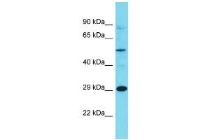 Western Blotting (WB) image for anti-Olfactory Receptor, Family 7, Subfamily E, Member 86 Pseudogene (OR7E86P) (C-Term) antibody (ABIN2791455) (OR7E86P Antikörper  (C-Term))