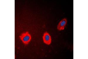 Immunofluorescent analysis of Cytokeratin 17 staining in HeLa cells. (KRT17 Antikörper  (C-Term))