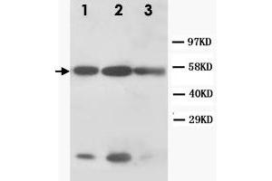 Western Blot analysis of KRT8 expression from cell extracts with KRT8 polyclonal antibody .
