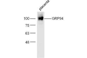 Mouse placenta lysates probed with Rabbit Anti-GRP94 Polyclonal Antibody, Unconjugated  at 1:500 for 90 min at 37˚C (GRP94 Antikörper  (AA 554-650))