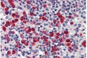 Human Spleen (formalin-fixed, paraffin-embedded) stained with LCN2 antibody ABIN337222 at 2. (Lipocalin 2 Antikörper  (AA 60-72))