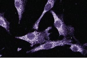 Immunofluorescent staining of NIH-3T3 cells. (LIM Domain Kinase 1 Antikörper  (AA 232-333))