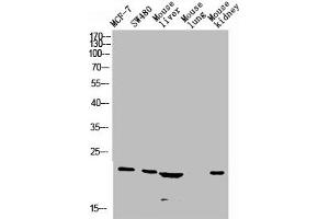 Western blot analysis of Jurkat U937 Raji mouse-eye lysate, antibody was diluted at 1000. (CGRP Antikörper  (AA 80-141))