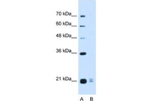 Western Blotting (WB) image for anti-Placenta-Specific 1-Like (PLAC1L) antibody (ABIN2463114) (PLAC1L Antikörper)