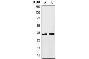 Western blot analysis of HOXA1 expression in HEK293T (A), HeLa (B) whole cell lysates.
