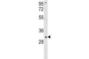 Western Blotting (WB) image for anti-Superoxide Dismutase 3, Extracellular (SOD3) (AA 7-36) antibody (ABIN3029037)