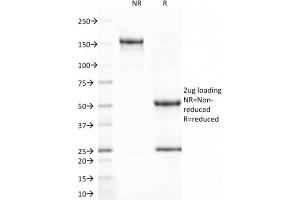 SDS-PAGE Analysis Purified CD80 Mouse Monoclonal Antibody (C80/2723). (CD80 Antikörper  (AA 35-142))