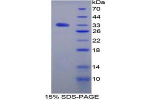 SDS-PAGE analysis of Rat TGFbR3 Protein. (TGFBR3 Protein)