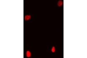 Immunofluorescent analysis of Coilin staining in Hela cells.