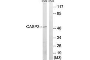 Western blot analysis of extracts from K562, using Caspase 2 (Ab-157) Antibody. (Caspase 2 Antikörper  (AA 123-172))