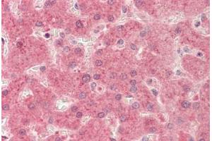 Human Liver: Formalin-Fixed, Paraffin-Embedded (FFPE)