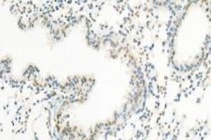 Immunohistochemistry (Paraffin-embedded Sections) (IHC (p)) image for anti-Pinin, Desmosome Associated Protein (PNN) antibody (ABIN7075083)