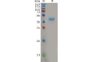 Human Protein, hFc Tag on SDS-PAGE under reducing condition.