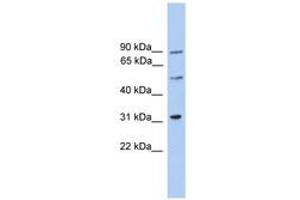 Image no. 1 for anti-Centrosomal Protein 57kDa-Like 1 (CEP57L1) (AA 141-190) antibody (ABIN6746415) (CEP57L1 Antikörper  (AA 141-190))