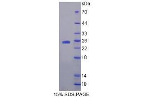 SDS-PAGE analysis of Human HPCA Protein. (Hippocalcin Protein (HPCA))