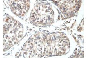 Immunohistochemical staining of formalin-fixed paraffin-embedded human fetal testis tissue showing nuclear staining with RBBP6 polyclonal antibody  at 1 : 100 dilution. (RBBP6 Antikörper  (N-Term))
