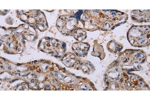 Immunohistochemistry of paraffin-embedded Human placenta using P3H3 Polyclonal Antibody at dilution of 1:50