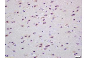 Formalin-fixed and paraffin embedded rat brain labeled with Anti Transglutaminase Polyclonal Antibody (ABIN719996), Unconjugated at 1:200, followed by conjugation to the secondary antibody and DAB staining (Transglutaminase Antikörper  (AA 461-560))