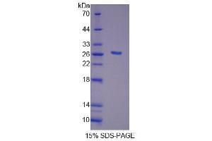 SDS-PAGE analysis of Human FGF20 Protein. (FGF20 Protein)