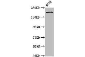 Western Blot Positive WB detected in: K562 whole cell lysate All lanes: PSME4 antibody at 4. (PSME4 Antikörper  (AA 105-198))