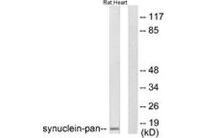 Western blot analysis of extracts from rat heart cells, using Synuclein-pan Antibody. (Synuclein Antikörper  (AA 15-64))