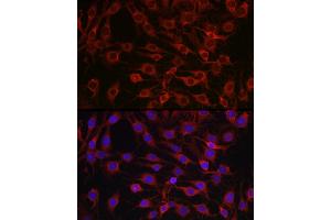 Immunofluorescence analysis of C6 cells using MARCKS Rabbit pAb (ABIN6134393, ABIN6143555, ABIN6143556 and ABIN6214033) at dilution of 1:100 (40x lens). (MARCKS Antikörper  (AA 1-100))