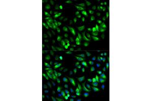 Immunofluorescence (IF) image for anti-Glycyl-tRNA Synthetase (GARS) antibody (ABIN1876623)