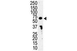 Western blot analysis of IRAK3 antibody and HL-60 cell lysate. (IRAK3 Antikörper  (AA 45-77))