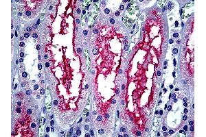 Anti-ACE-2 antibody IHC of human kidney. (ACE2 Antikörper  (Internal Region))